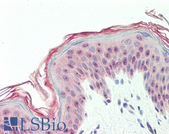 Human, Skin: Formalin-Fixed Paraffin-Embedded (FFPE)