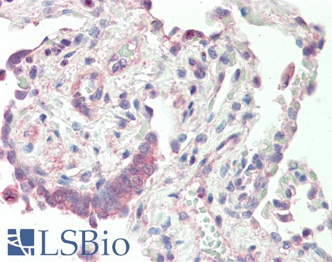 Human, Lung: Formalin-Fixed Paraffin-Embedded (FFPE)