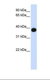 Fetal muscle lysate. Antibody concentration: 1.0 ug/ml. Gel concentration: 12%.