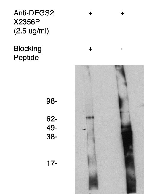 Western blot of antigen immunoaffinity purified and DEGS2 antibody (LS-C140611) on human kidney cell lysate. Lysate used at 15 ug/lane. Antibody used at 1:400 dilution. Secondary antibody, mouse anti-rabbit HRP, used at 1:50k dilution. Visualized using Pierce West Femto substrate system. Exposure for 5 minutes
