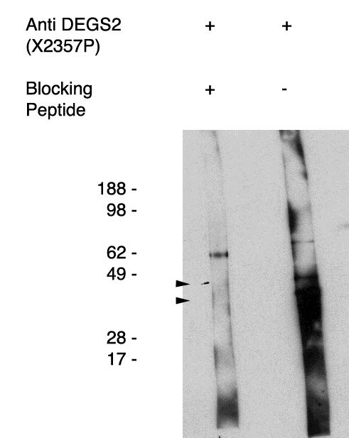 Western blot of antigen immunoaffinity purified anti DEGS2 antibody (LS-C140612) on human kidney cell lysate. Lysate used at 15 ug/lane. Antibody used at 1:400 dilution. Secondary antibody, mouse anti-rabbit HRP, used at 1:50k dilution. Visualized using Pierce West Femto substrate system. Exposure for 5 minutes