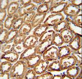 DEGS2 antibody immunohistochemistry of formalin-fixed and paraffin-embedded human kidney tissue followed by peroxidase-conjugated secondary antibody and DAB staining.