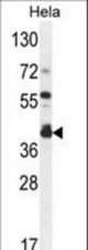 DEGS2 Antibody western blot of HeLa cell line lysates (35 ug/lane). The DEGS2 antibody detected the DEGS2 protein (arrow).