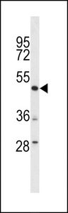 Western blot of lysates from U-251 MG, PC-3 cell line (from left to right), using DEK Antibody. Antibody was diluted at 1:1000 at each lane. A goat anti-rabbit IgG H&L (HRP) at 1:5000 dilution was used as the secondary antibody. Lysates at 35ug per lane.