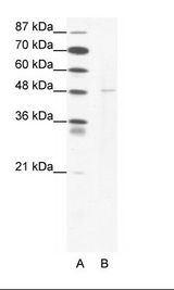 A: Marker, B: Jurkat Cell Lysate