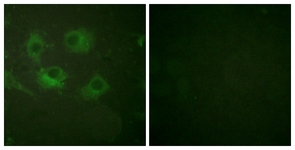 Immunofluorescence of HUVEC cells, using Claudin 3 Antibody. The picture on the right is treated with the synthesized peptide.