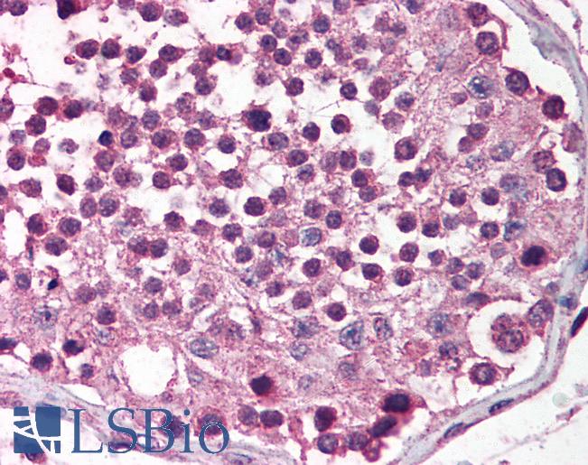 Anti-MADD antibody IHC of human testis. Immunohistochemistry of formalin-fixed, paraffin-embedded tissue after heat-induced antigen retrieval. Antibody LS-B583 concentration 5 ug/ml.