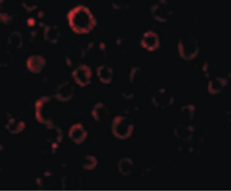Immunofluorescence of MADD in HeLa cells with MADD antibody at 20 ug/ml.