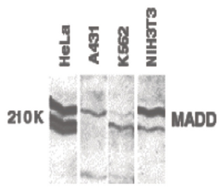 Western blot of MADD in whole cell lysates from the indicated cell lines with MADD antibody at 1:250 dilution.
