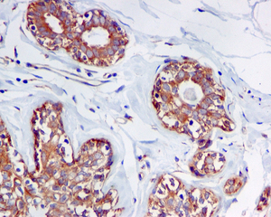 IHC of paraffin-embedded human breast tissue using anti-MADD antibody. 
