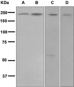 Western blot analysis on (A) HeLa, (B) 293T, (C) K562, and (D) NIH/3T3 cell lysates using anti-MADD antibody.