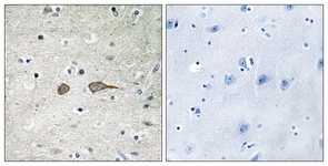 IHC of paraffin-embedded human brain tissue, using MADD Antibody. The picture on the right is treated with the synthesized peptide.