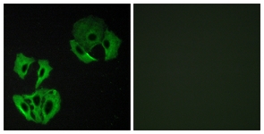 Immunofluorescence of A549 cells, using MADD Antibody. The picture on the right is treated with the synthesized peptide.