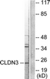 Western blot of extracts from HUVEC cells, using Claudin 3 Antibody. The lane on the right is treated with the synthesized peptide.