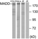 Western blot of extracts from COLO/HeLa/Jurkat cells, using MADD Antibody. The lane on the right is treated with the synthesized peptide.