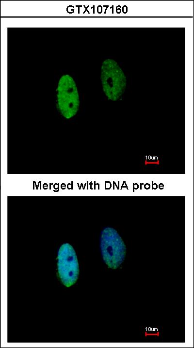 Immunofluorescence of paraformaldehyde-fixed HeLa using DENND1B antibody at 1:200 dilution.
