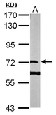 Sample (50 ug of whole cell lysate). A: Mouse brain. 7.5% SDS PAGE. DENND1B antibody diluted at 1:1000.