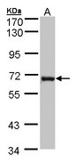 Sample (30 ug of whole cell lysate). A: MOLT4 . 7.5% SDS PAGE. DENND1B antibody diluted at 1:1000