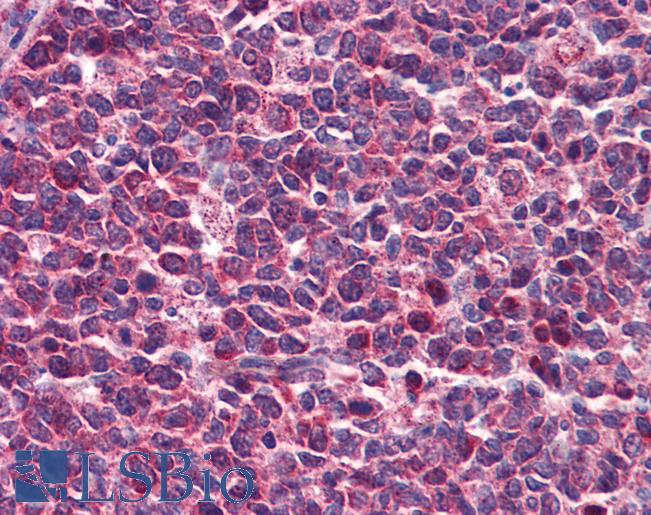 Anti-DENND1B antibody IHC of human tonsil. Immunohistochemistry of formalin-fixed, paraffin-embedded tissue after heat-induced antigen retrieval. Antibody LS-B5833 concentration 5 ug/ml.