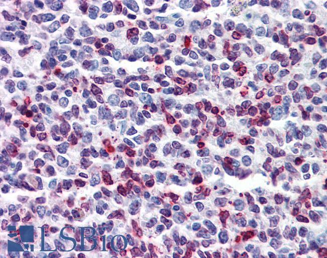 Anti-DENND1B antibody IHC of human tonsil. Immunohistochemistry of formalin-fixed, paraffin-embedded tissue after heat-induced antigen retrieval. Antibody LS-B5832 concentration 5 ug/ml.