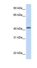 DENND1B antibody LS-B5832 Western blot of Fetal Muscle lysate.