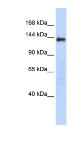 DENND2C antibody LS-C102543 Western blot of Transfected 293T cell lysate.