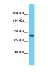 Western blot of Human Jurkat. DENND4C antibody dilution 1.0 ug/ml.