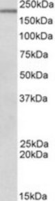 DENND4C antibody (0.5 ug/ml) staining of Mouse Spleen lysate (35 ug protein/ml in RIPA buffer). Primary incubation was 1 hour. Detected by chemiluminescence.