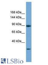 DENND5A antibody Western Blot of 721_B. Antibody dilution: 1 ug/ml.
