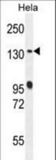 DEN5A Antibody western blot of HeLa cell line lysates (35 ug/lane). The DEN5A antibody detected the DEN5A protein (arrow).
