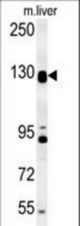 DENND5B Antibody western blot of mouse liver tissue lysates (15 ug/lane). The DENND5B antibody detected DENND5B protein (arrow).