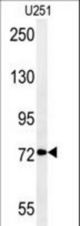 DEPDC1 Antibody western blot of U251 cell line lysates (35 ug/lane). The DEPDC1 antibody detected the DEPDC1 protein (arrow).