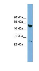 DEPDC7 antibody LS-C116423 Western blot of NCI-H226 cell lysate.