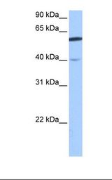 Fetal brain cell lysate. Antibody concentration: 1.0 ug/ml. Gel concentration: 12%.