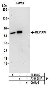 Detection of Human DEPDC7 by Western Blot of Immunoprecipitates. Samples: Whole cell lysate (1 mg for IP; 20% of IP loaded) from HeLa cells. Antibodies: Affinity purified rabbit anti-DEPDC7 antibody used for IP at 6 ug/mg lysate. DEPDC7 was also immunoprecipitated by rabbit anti-DEPDC7 antibody BL14812. For blotting immunoprecipitated DEPDC7, was used at 0.4 ug/ml. Detection: Chemiluminescence with an exposure time of 3 minutes.