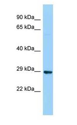DERA antibody Western Blot of THP-1. Antibody dilution: 1 ug/ml.