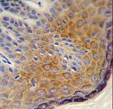 Formalin-fixed and paraffin-embedded human skin reacted with DERA Antibody , which was peroxidase-conjugated to the secondary antibody, followed by DAB staining. This data demonstrates the use of this antibody for immunohistochemistry; clinical relevance has not been evaluated.