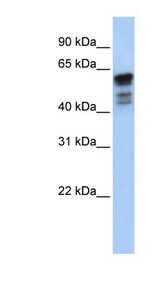 DES / Desmin antibody LS-C110641 Western blot of Fetal Muscle lysate.