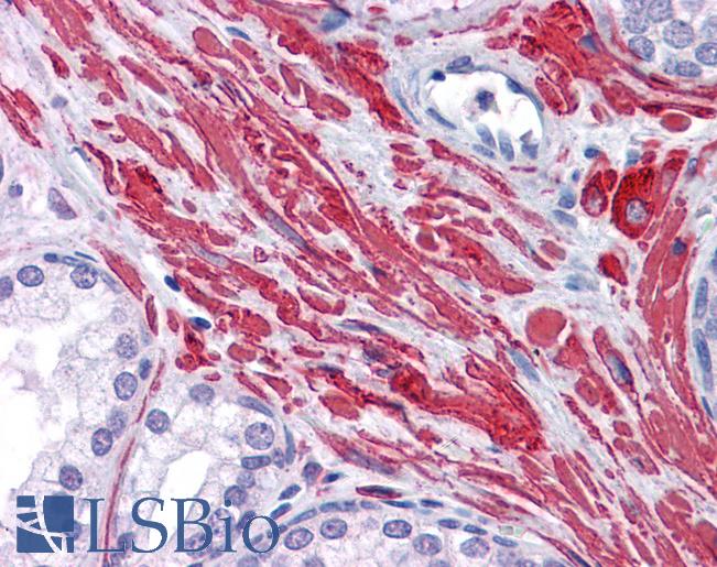 Anti-DES / Desmin antibody IHC of human prostate. Immunohistochemistry of formalin-fixed, paraffin-embedded tissue after heat-induced antigen retrieval. Antibody LS-B4463 concentration 3.75 ug/ml.