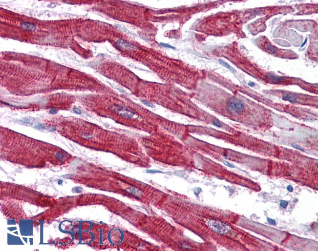 Anti-DES / Desmin antibody IHC of human heart. Immunohistochemistry of formalin-fixed, paraffin-embedded tissue after heat-induced antigen retrieval. Antibody LS-B4463 concentration 3.75 ug/ml.