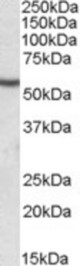 Antibody (0.2 ug/ml) staining of Human Skeletal Muscle lysate (35 ug protein in RIPA buffer). Primary incubation was 1 hour. Detected by chemiluminescence.