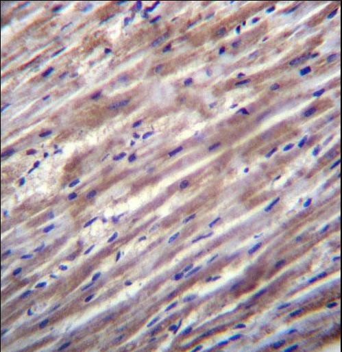 RASD1 Antibody immunohistochemistry of formalin-fixed and paraffin-embedded human heart tissue followed by peroxidase-conjugated secondary antibody and DAB staining.