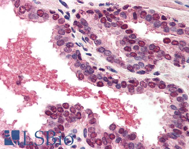 Anti-DFFA / ICAD antibody IHC of human prostate. Immunohistochemistry of formalin-fixed, paraffin-embedded tissue after heat-induced antigen retrieval. Antibody LS-B558 concentration 5 ug/ml.