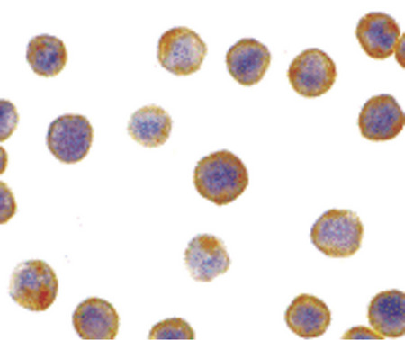 Immunocytochemistry of DFF45 in HeLa cells with DFF45 antibody at 5 ug/ml.