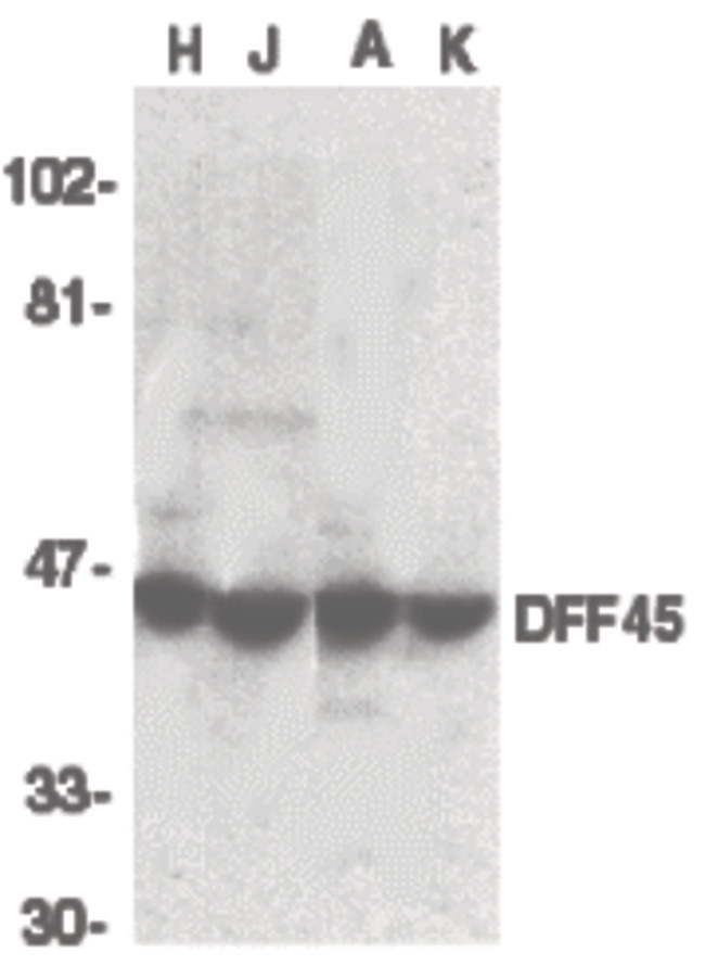 Western blot of DFF45 in HeLa (H), Jurkat (J), A431 (A), and K562 (K) whole cell lysate with DFF45 antibody at 1:1000 dilution.