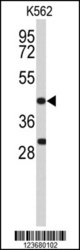 Western blot of DFFA Antibody in K562 cell line lysates (35 ug/lane). DFFA (arrow) was detected using the purified antibody.
