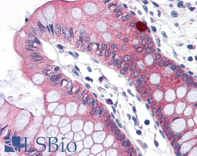 Anti-CLDN5 / Claudin 5 antibody IHC of human colon. Immunohistochemistry of formalin-fixed, paraffin-embedded tissue after heat-induced antigen retrieval. Antibody LS-B3064 concentration 15 ug/ml.