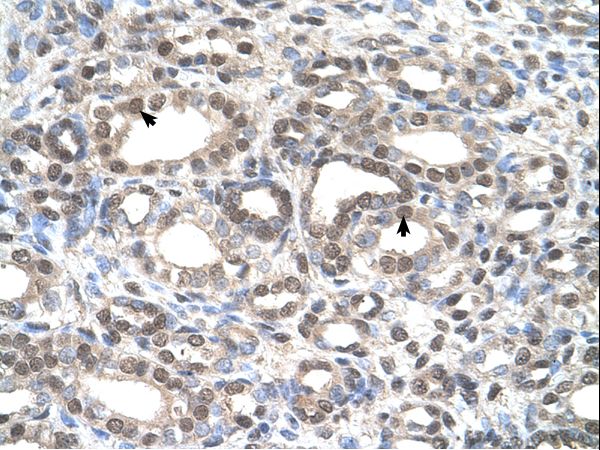 DFNA5 antibody LS-C80828 was used in IHC to stain formalin-fixed, paraffin-embedded human kidney.