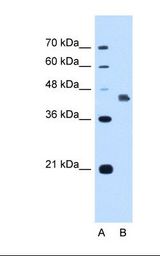 Lane A: Marker. Lane B: HepG2 cell lysate. Antibody concentration: 1.25 ug/ml. Gel concentration: 12%.