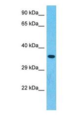 Western blot of DFNA5 Antibody with human 293T Whole Cell lysate.
